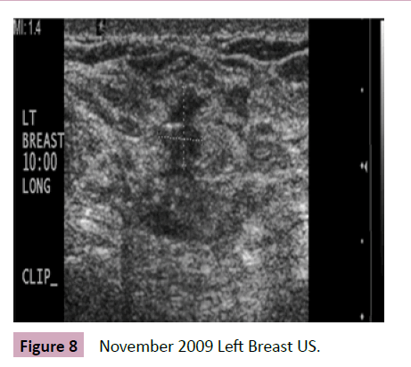 adenocarcinoma-November