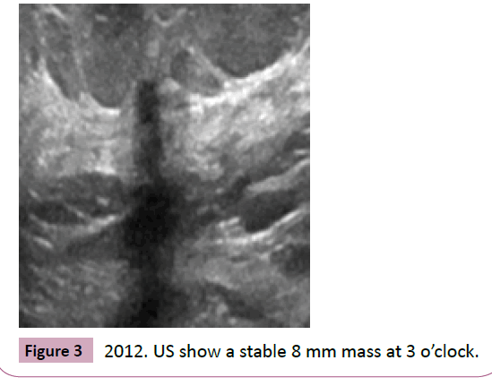 adenocarcinoma-show-stable